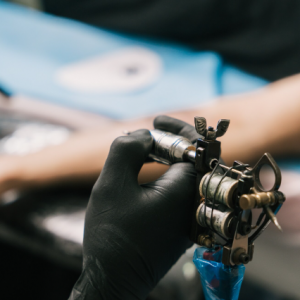 Détatouage de motifs divers à Sarcelles. Suppression progressive des pigments indésirables.